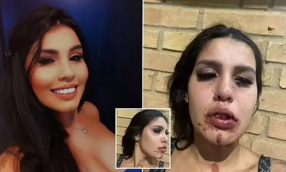 INSTAGRAM STAR IS ‘DRUGGED, GANG-R@PED AND BEATEN BY HER FELLOW INFLUENCERS